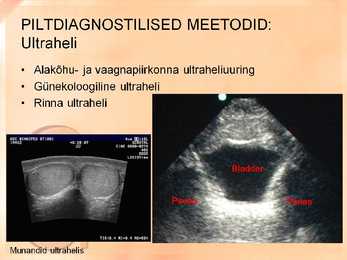 Naise ja mehe urogenitaalsüsteemi uurimine slideshow #7