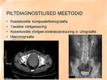 Naise ja mehe urogenitaalsüsteemi uurimine slideshow #8