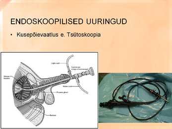 Naise ja mehe urogenitaalsüsteemi uurimine slideshow #10
