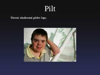 Pärilikud Haigused-nende põhjused ja ravi #13