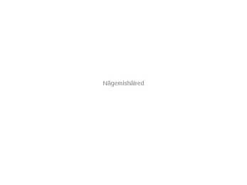 Nägemishäired - ettekanne
