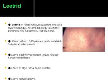 Viirushaigused esitlus #3