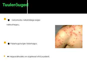 Viirushaigused esitlus #4