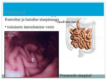Seedeelundkond powerpoint #10