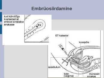 Kunstlik viljastamine ja embrüosiirdamine #7