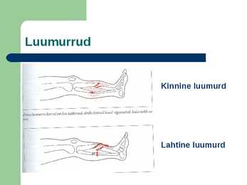Luumurrud ja esmaabi #3