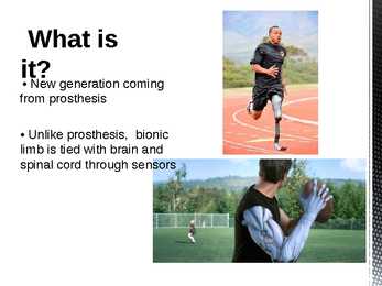 Artificial limbs Presentatsion #3