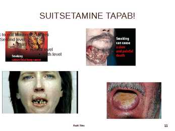 Suitsetamine #11
