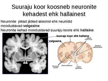 Aju närvissteem #22