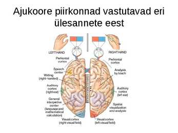 Aju närvissteem #29