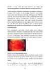Diabeetiline retinopaatia #15