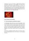Diabeetiline retinopaatia #10