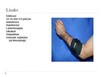 Epicondylitis lateralis #10