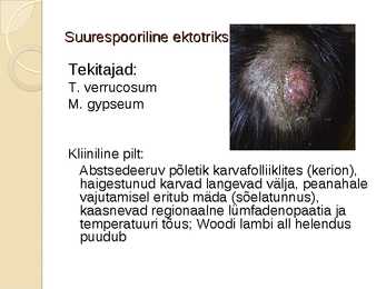 Juustega kaetud peanaha dermatofüütia #7