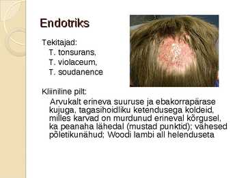 Juustega kaetud peanaha dermatofüütia #8