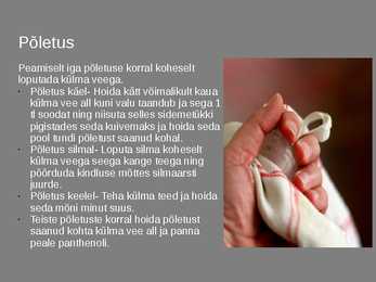 Ohutus köögis #4