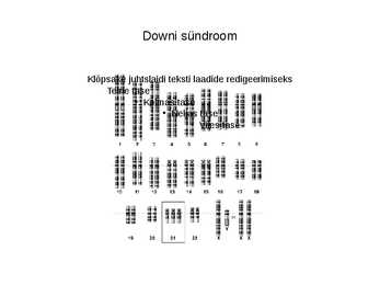 Downi sündroom #13