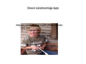 Downi sündroom #14