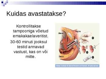 Haigus klamüüdia-- Chlamydia #12