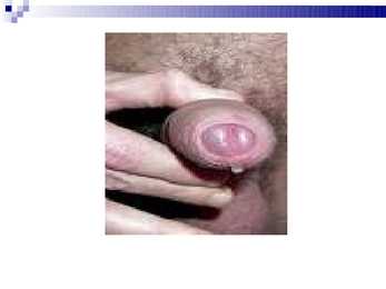 Haigus klamüüdia-- Chlamydia #8