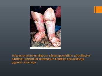 DIABEET-DIABEEDILIIGID- TOITUMINE JA RAVIMID DIABEEDI PUHUL #6