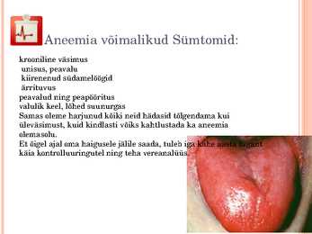 Aneemia #12