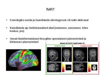 Andmetöötlus funktsionaalse seotuse hindamiseks puhkeoleku fMRT-s #2