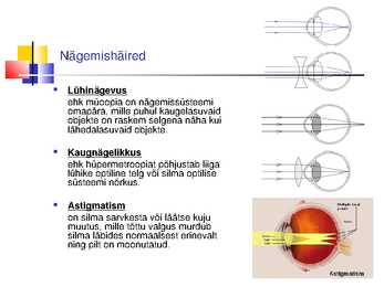 Laserite kasutamine silmakirurgias #13
