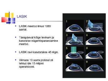 Laserite kasutamine silmakirurgias #15