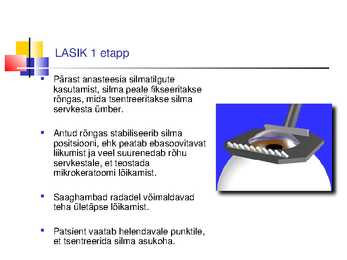 Laserite kasutamine silmakirurgias #17