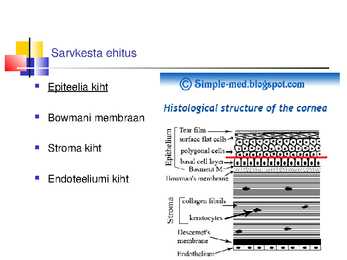Laserite kasutamine silmakirurgias #32