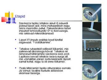 Laserite kasutamine silmakirurgias #38