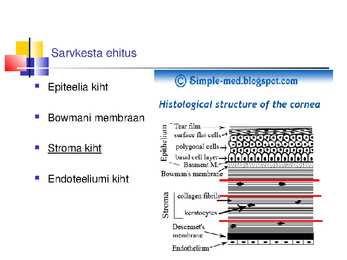 Laserite kasutamine silmakirurgias #39